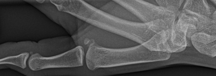 Anwalt Fehldiagnose