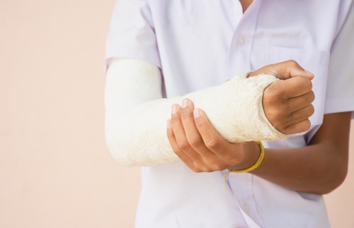 Arm im Gips nach einem Verkehrsunfall