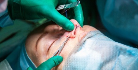 Missglückte Schönheits-OP: Welche Rechte haben Patienten?